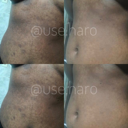 Sabonete Clareador - Pague 3 e Leve 5