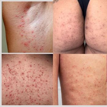 Sabonete Clareador - Pague 3 e Leve 5