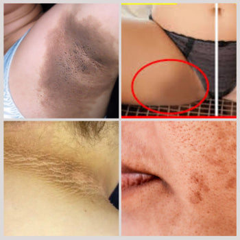 Sabonete Clareador - Pague 3 e Leve 5